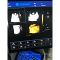Портативный Цвет doppler сердца Цена УЗИ аппарат медицинский Сонар 2Д 3Д 4Д Эхокардиография сканер долл Эхо машина